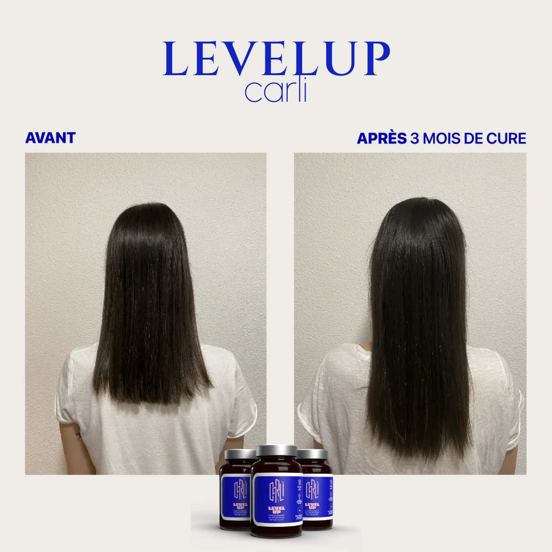 Avant / Après Levelup